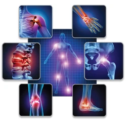 Illustration of osteoarthritis pain points for low-dose radiation therapy